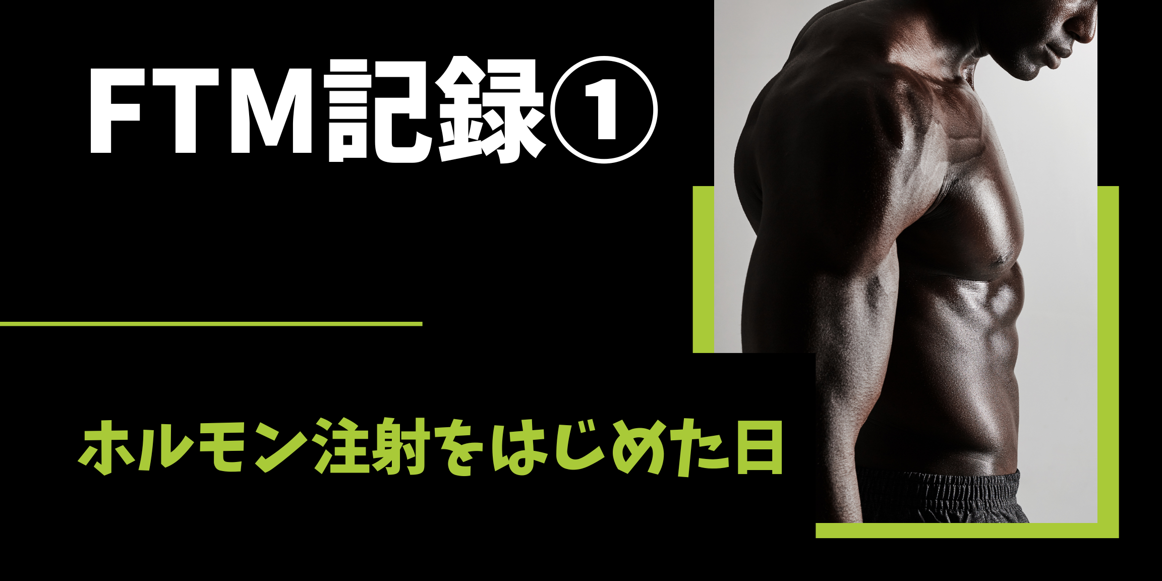 FTMホルモン注射を始めた日のこと—きっかけと最初の一歩